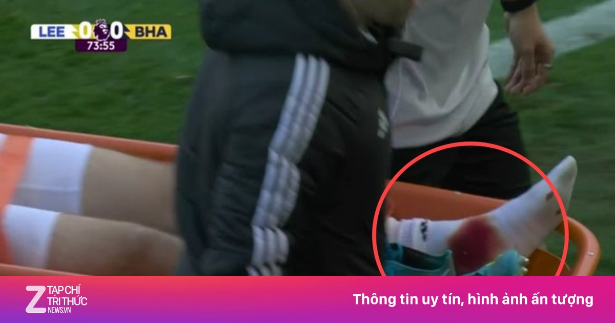 Chấn thương ghê rợn gây sốc cho tuyển Đức