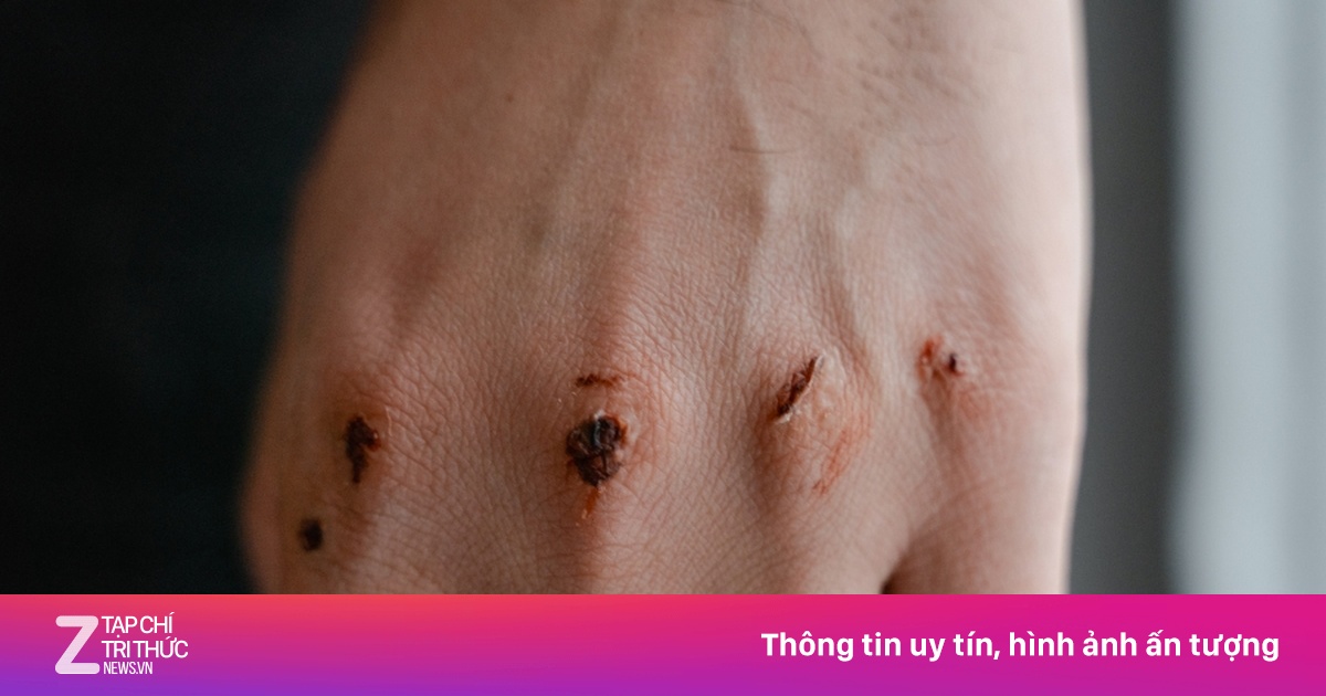 Nỗi đau tinh thần hóa thành vết cắt trên da thịt