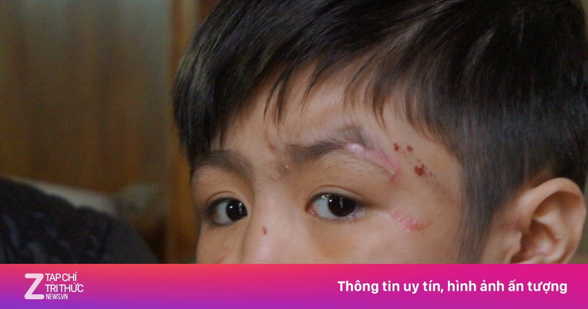 Bé trai 10 tuổi kể phút tháo chạy khỏi nhà bố  - Pháp luật - ZNEWS.VN 