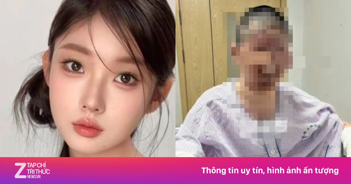 Người mẫu Đồng Dao trước khi bị biến dạng gương mặt
