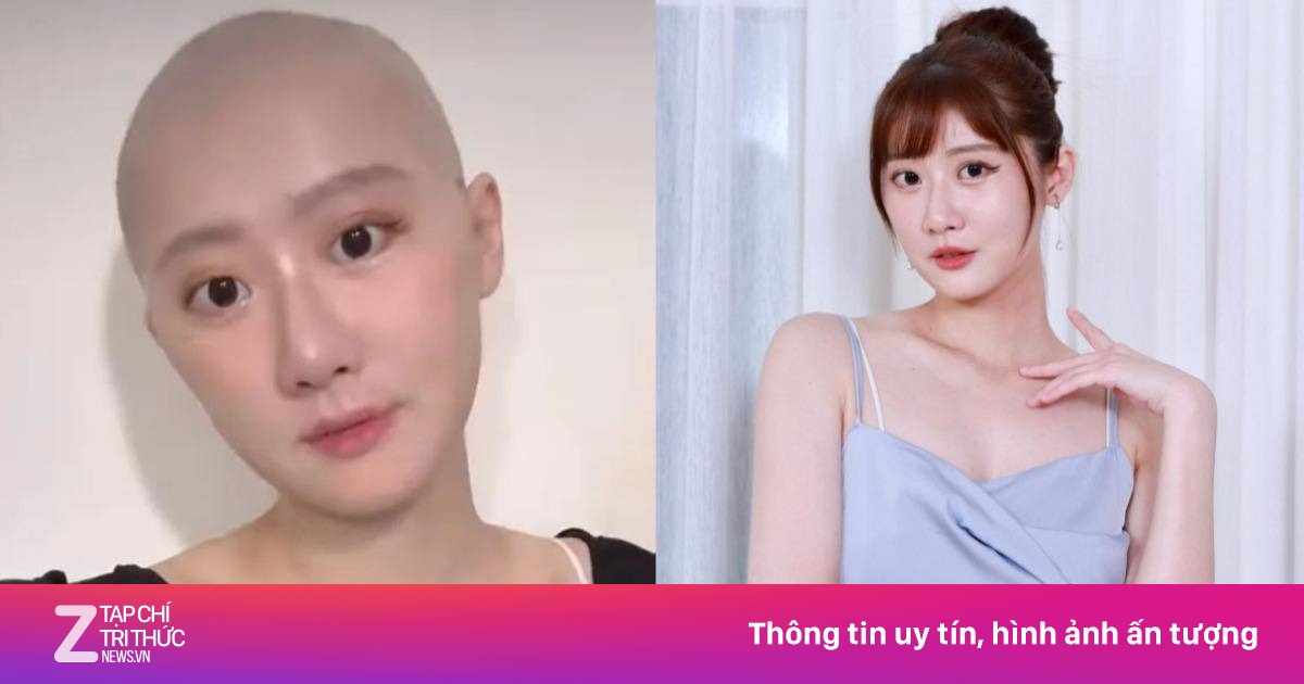 Nữ diễn viên suy sụp sau 6 đợt hoá trị ung thư