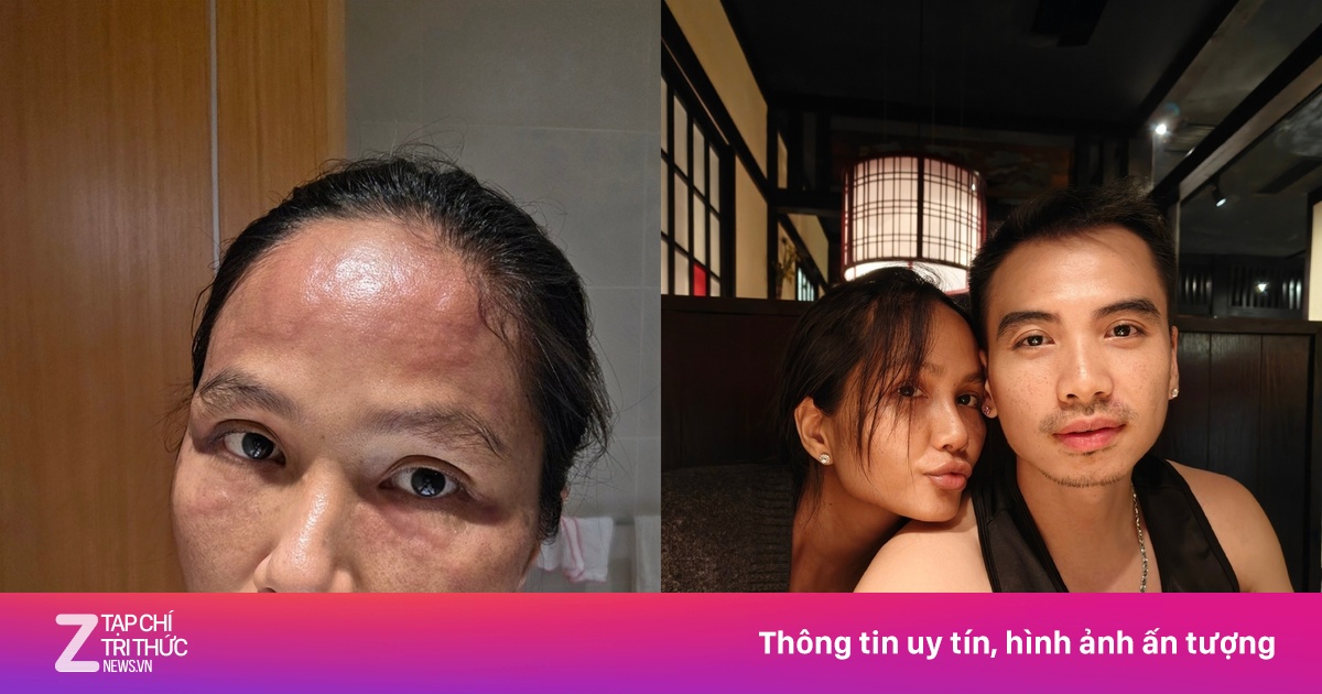 Tình trạng H'Hen Niê hiện tại