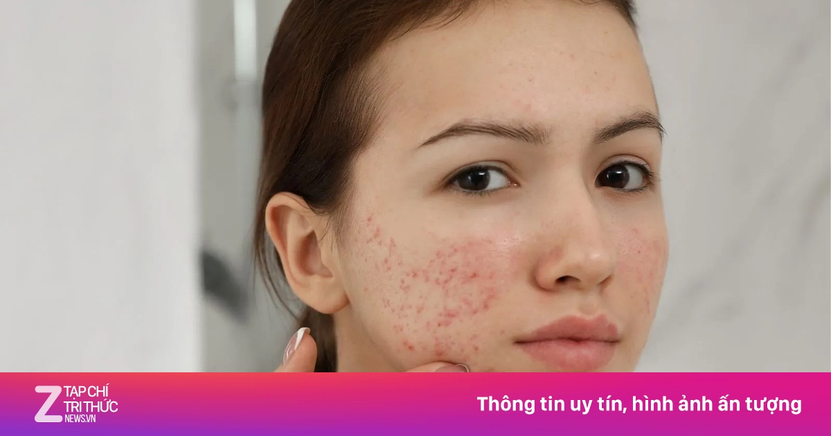 8 thực phẩm giúp gan khỏe, giải độc