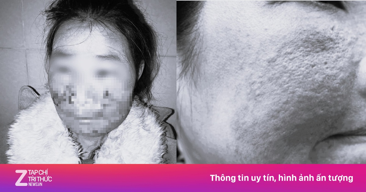 Mỹ phẩm nhà làm: Xanh lành hay 'xanh mặt'?