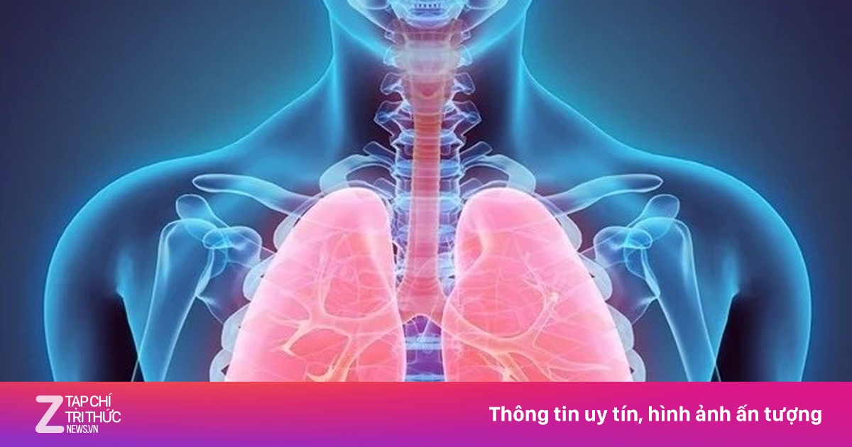 Căn bệnh gây tổn thương phổi gấp 3 lần hút thuốc