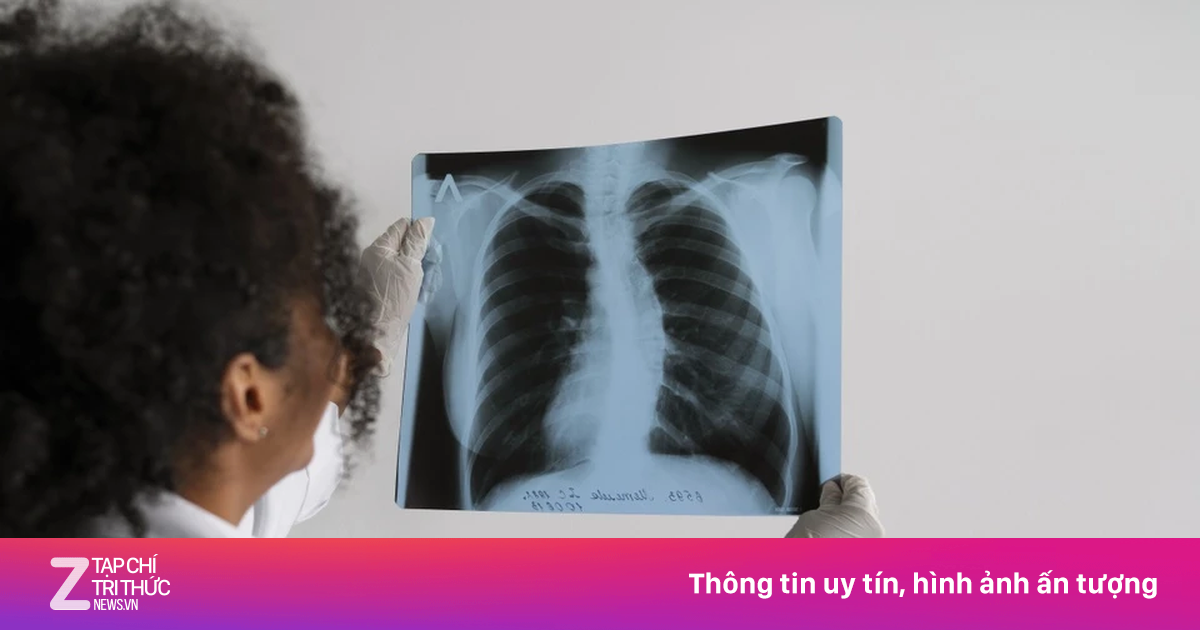 6 lầm tưởng phổ biến ở người mắc bệnh phổi