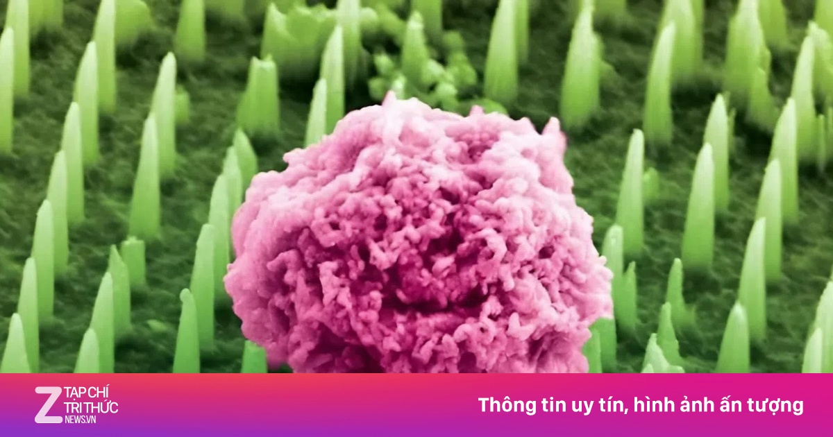 Phát hiện ung thư nhờ một miếng dán siêu nhỏ