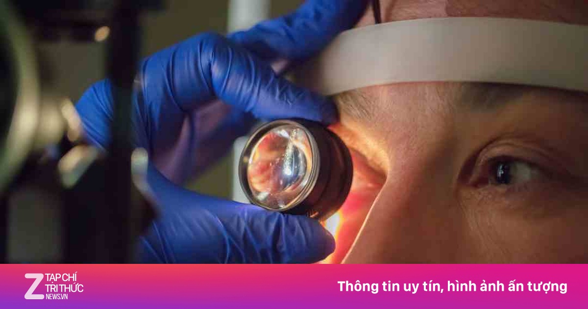 Căn bệnh gây mù lòa không đau, không đỏ, không ngứa