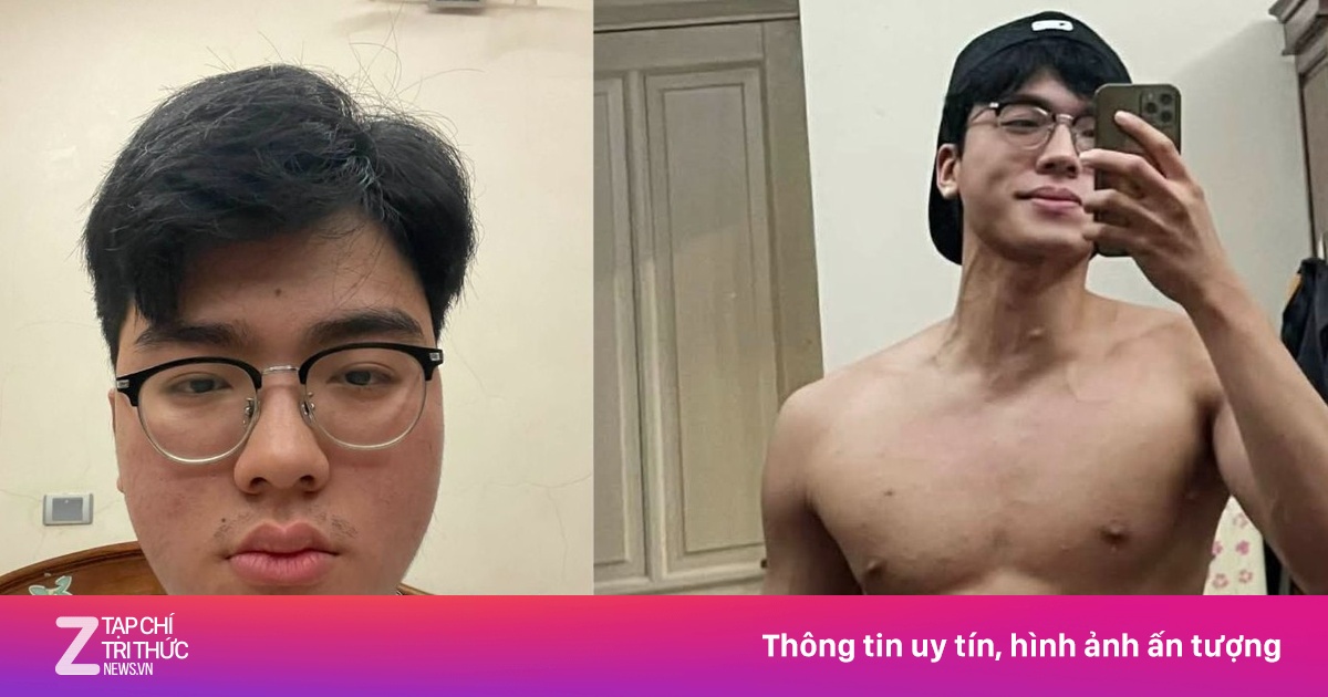 Diện mạo khác lạ của nam người mẫu sau 2 năm mắc bệnh thận