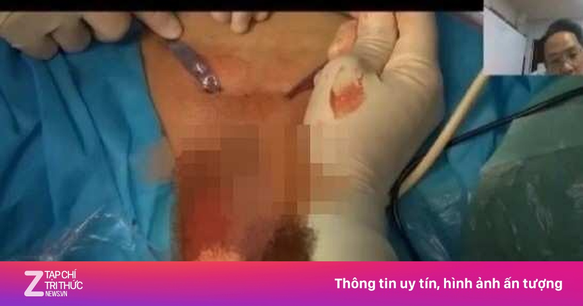 Bệnh viện Trung Quốc gây phẫn nộ vì livestream lộ vùng kín bệnh nhân