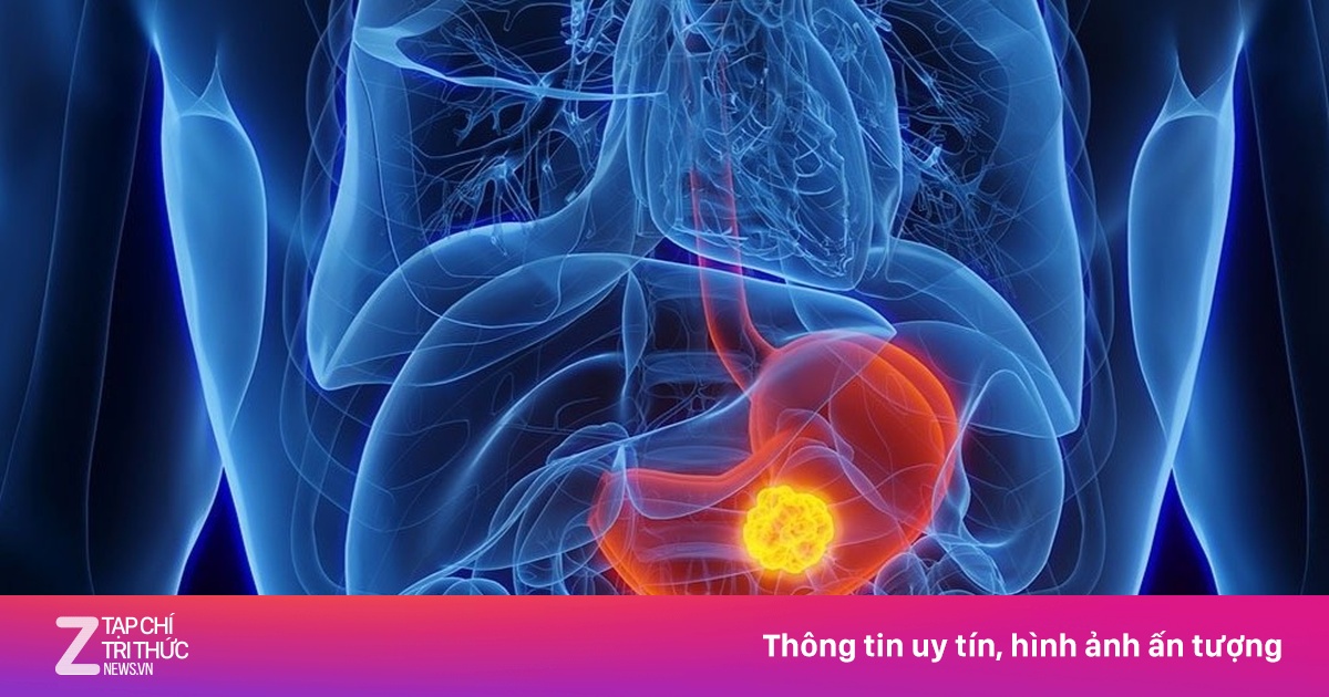 Chàng trai 23 tuổi phát hiện ung thư dạ dày giai đoạn cuối
