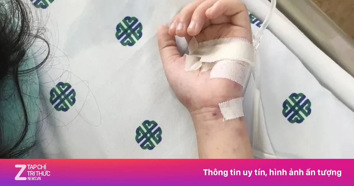 Xác định nguyên nhân khiến bé gái ở Phú Quốc không qua khỏi