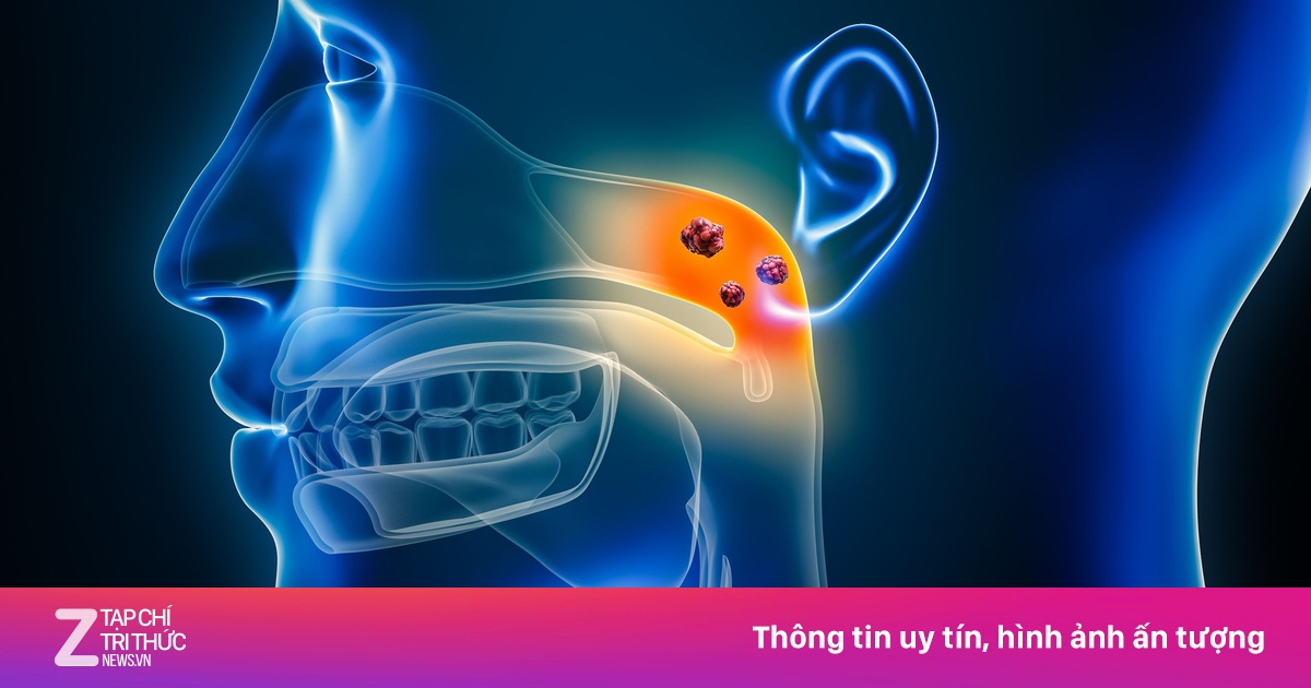 Người đàn ông phát hiện ung thư vòm họng từ triệu chứng không ngờ