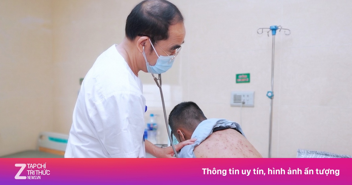 Thủy đậu bội nhiễm: Bệnh nhân 35 tuổi nhập viện với dày đặc nốt mủ đục vì chủ quan