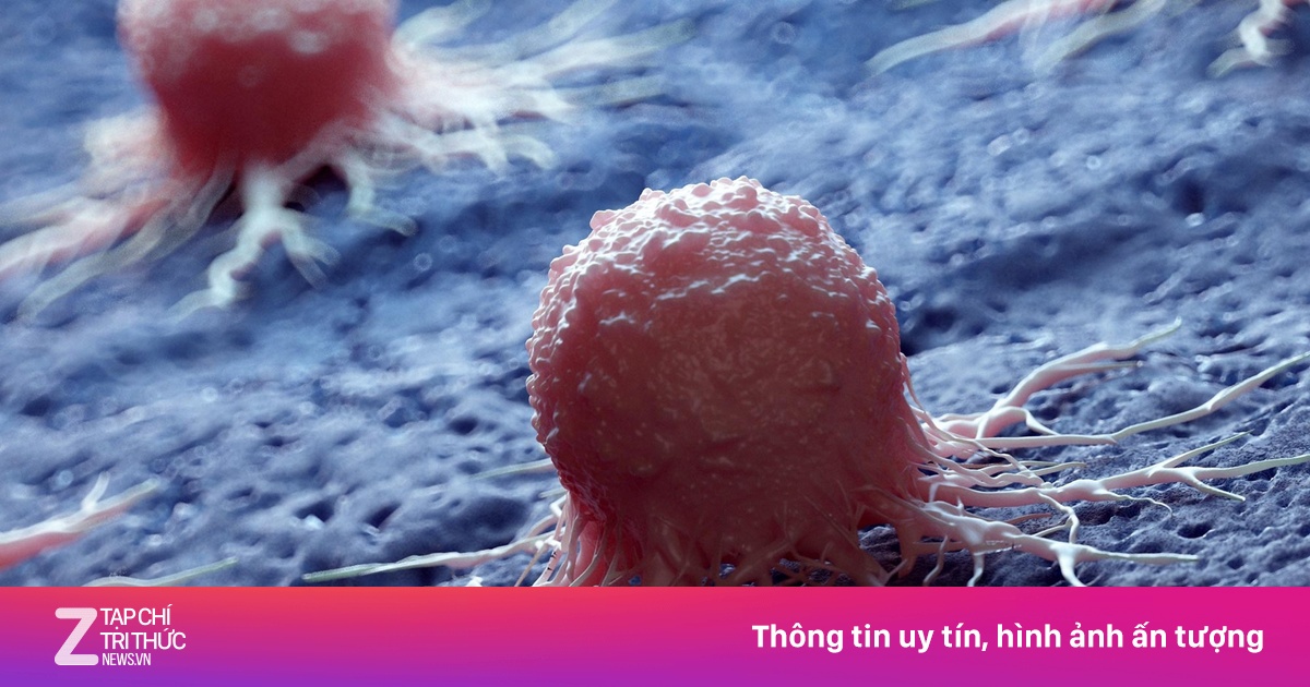 Loại ung thư 'ngụy trang' tinh vi, ngày càng nhiều người trẻ mắc phải