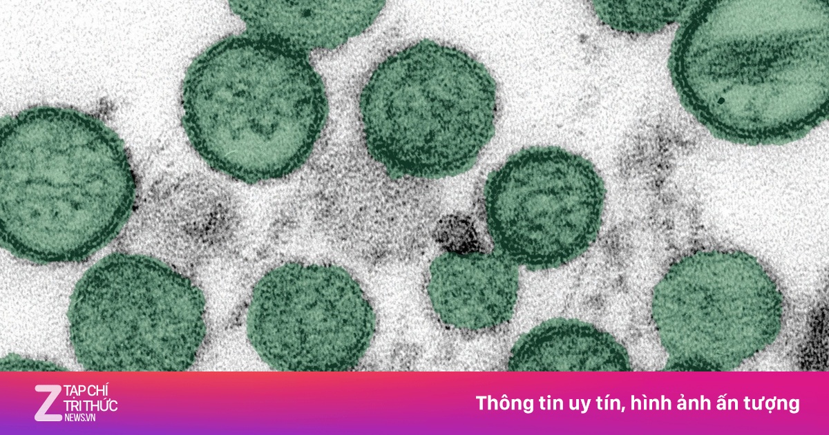 3 người không qua khỏi do bệnh dịch nguy hiểm trên tàu qua Nam Cực