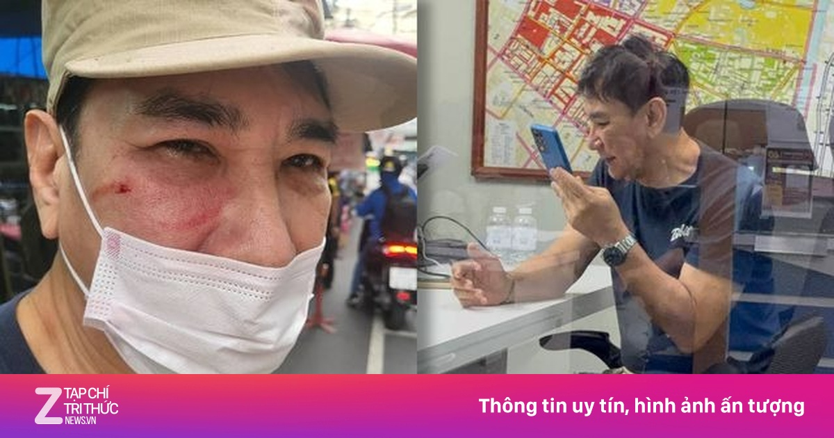 Diễn viên Thái bị hành hung giữa đường
