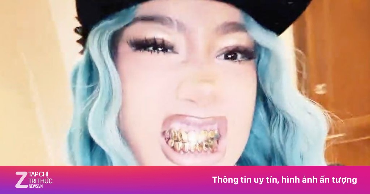 Con gái 12 tuổi của Kim Kardashian bọc vàng cả hàm răng