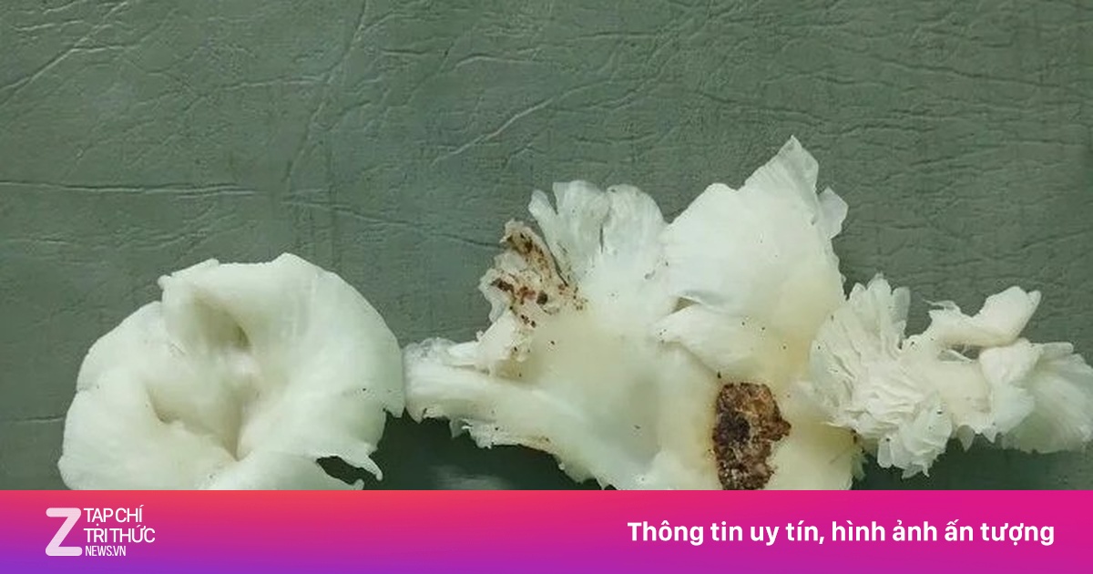 Ăn nấm lạ, 3 người trong một gia đình co giật, trụy tim mạch | Znews.vn