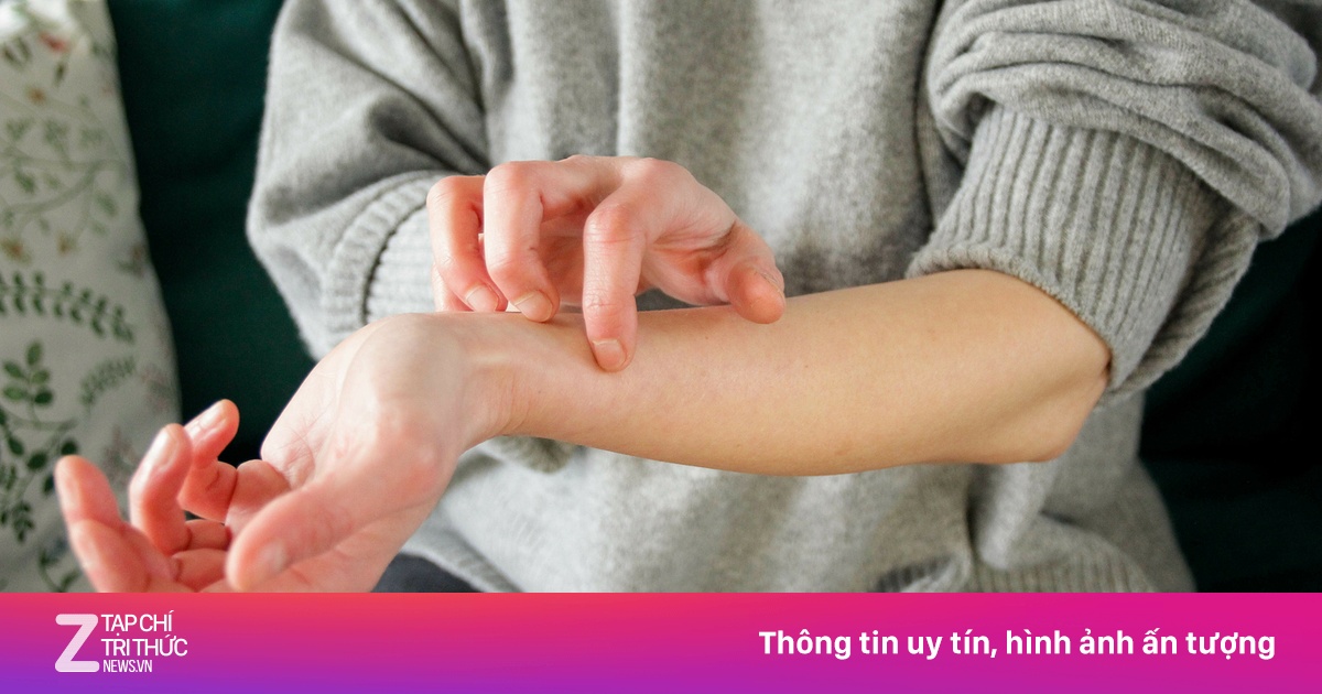 5 cảnh báo bệnh gan biểu hiện ngay trên da
