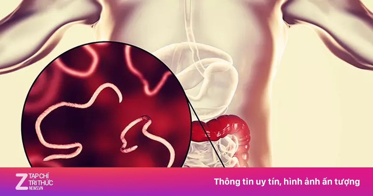 Dấu hiệu nhận biết bạn đã nhiễm giun kim