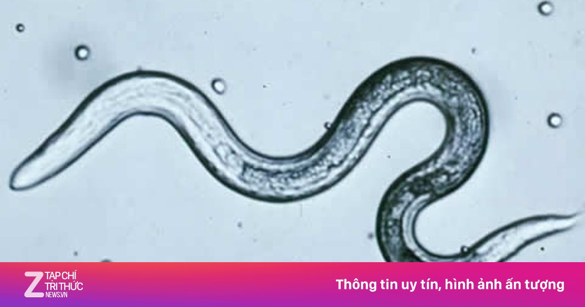 3 loại thuốc trị giun kim