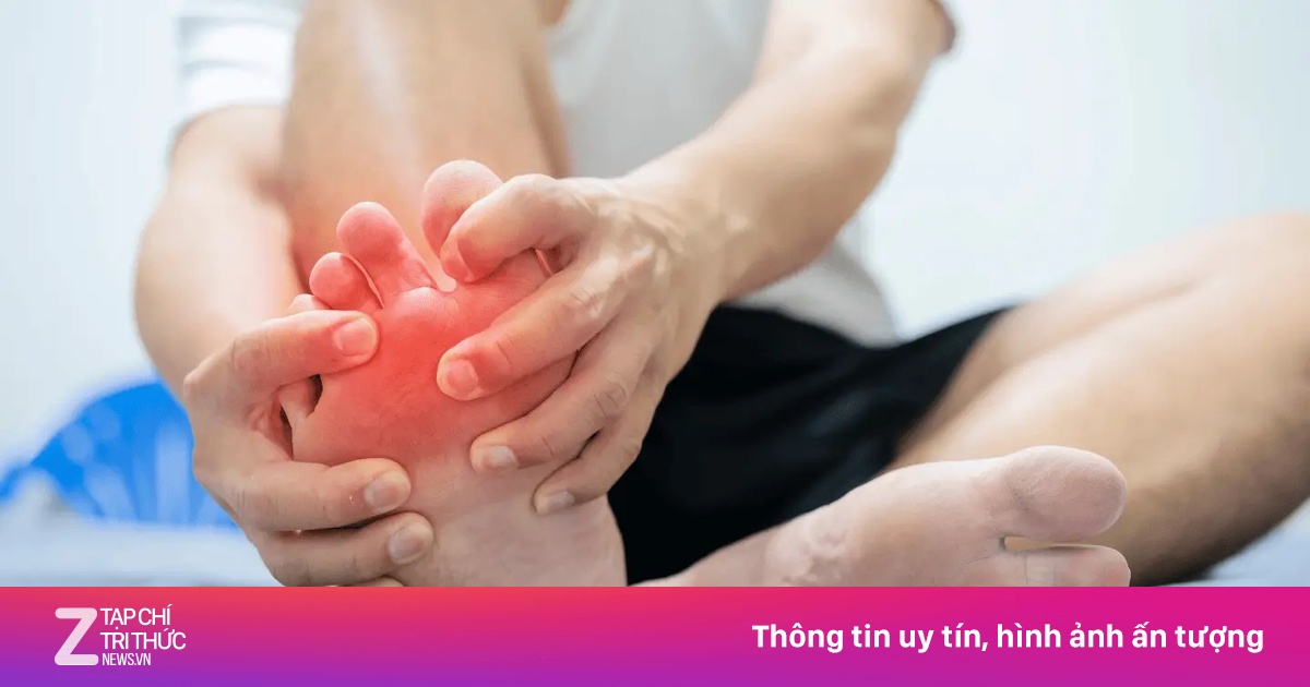 Các tác nhân phổ biến gây bệnh gout