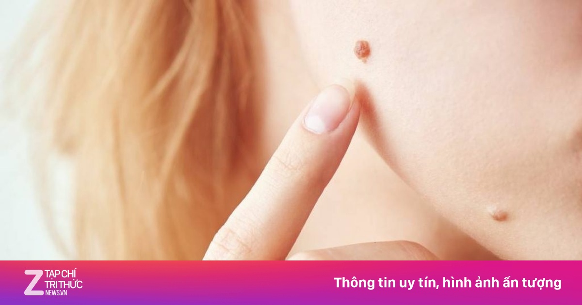 Có 8 dấu hiệu này trên mặt, nên đi khám sớm