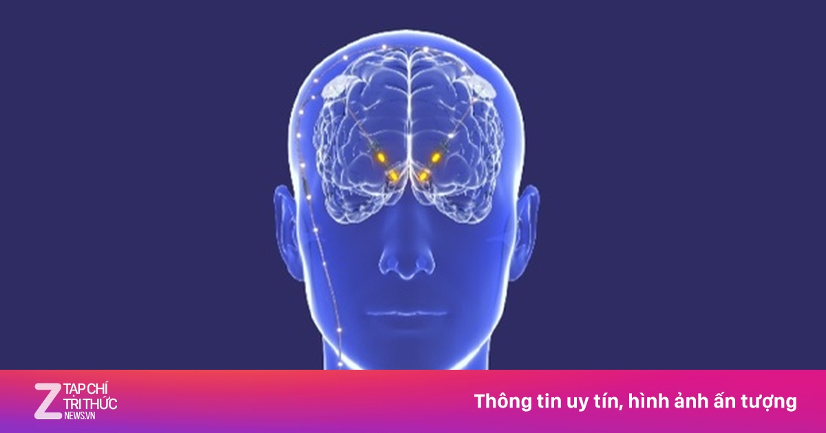 Trung Quốc: Tranh cãi thử nghiệm cấy ghép não điều trị nghiện ma túy