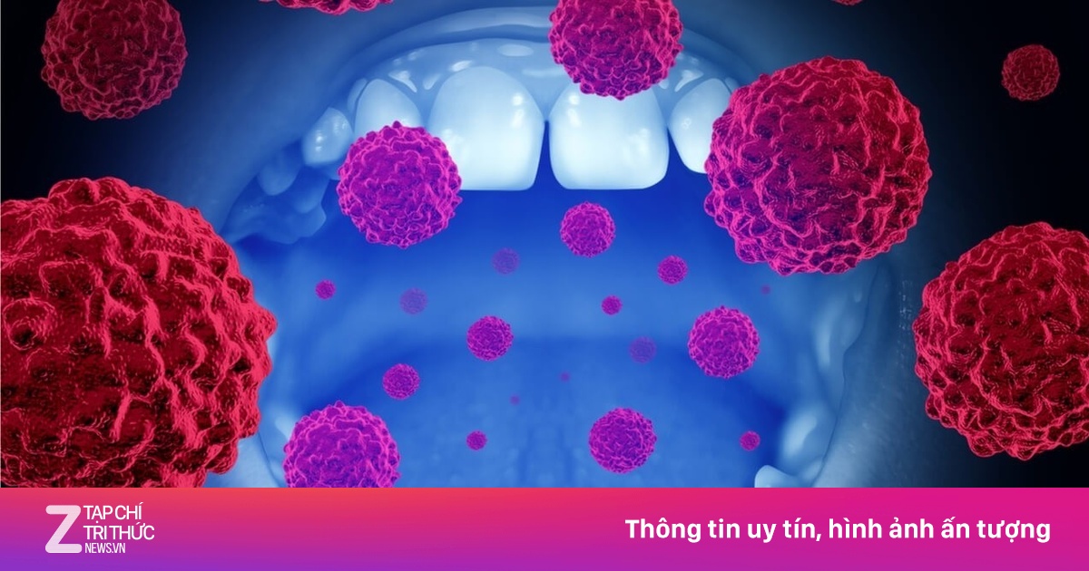 Thói quen âm thầm 'nuôi dưỡng' ung thư miệng
