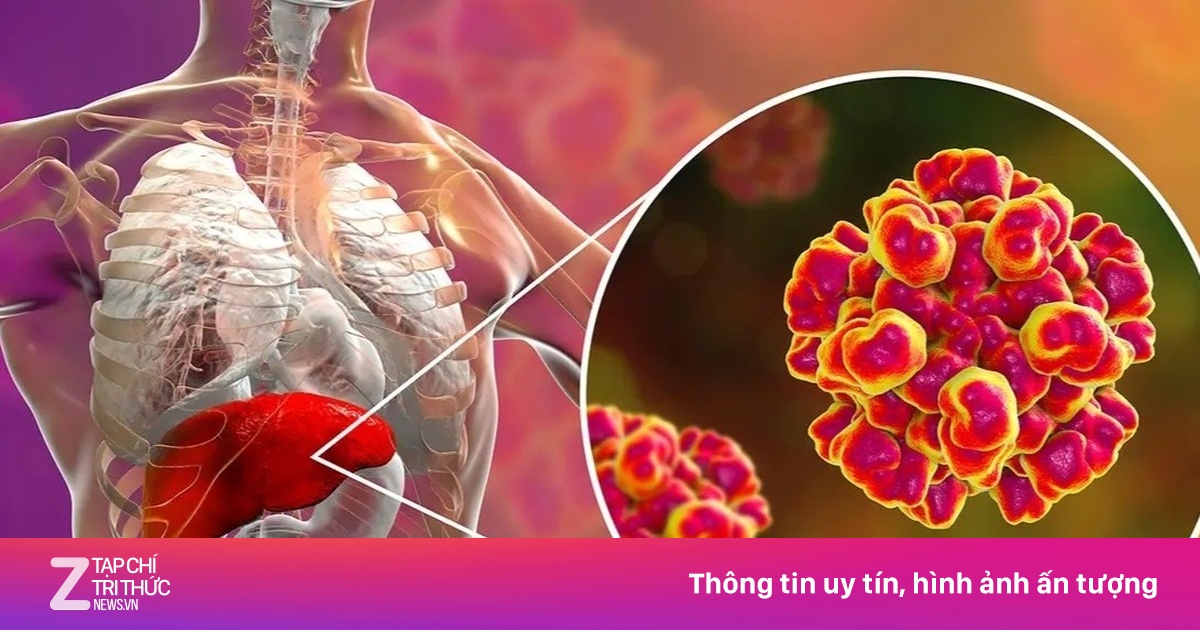 Viêm gan E: Đường lây truyền và phương pháp điều trị cần biết