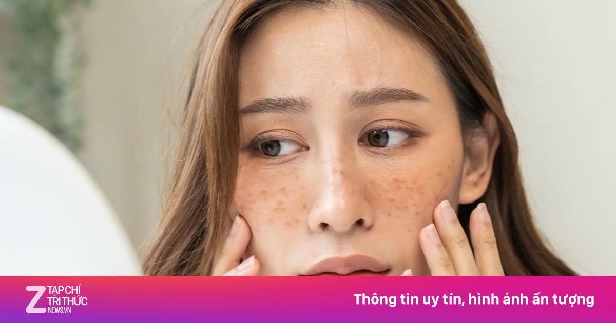 Dấu hiệu cảnh báo cơ thể thiếu magiê trầm trọng qua những bất thường trên khuôn mặt
