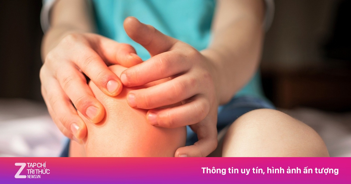 Dấu hiệu trẻ bị thiếu canxi