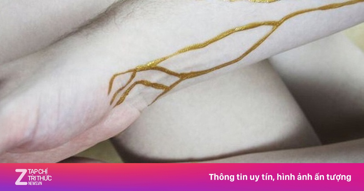 Phát hiện nhóm máu hiếm hơn 'máu vàng', chỉ 3 người sở hữu