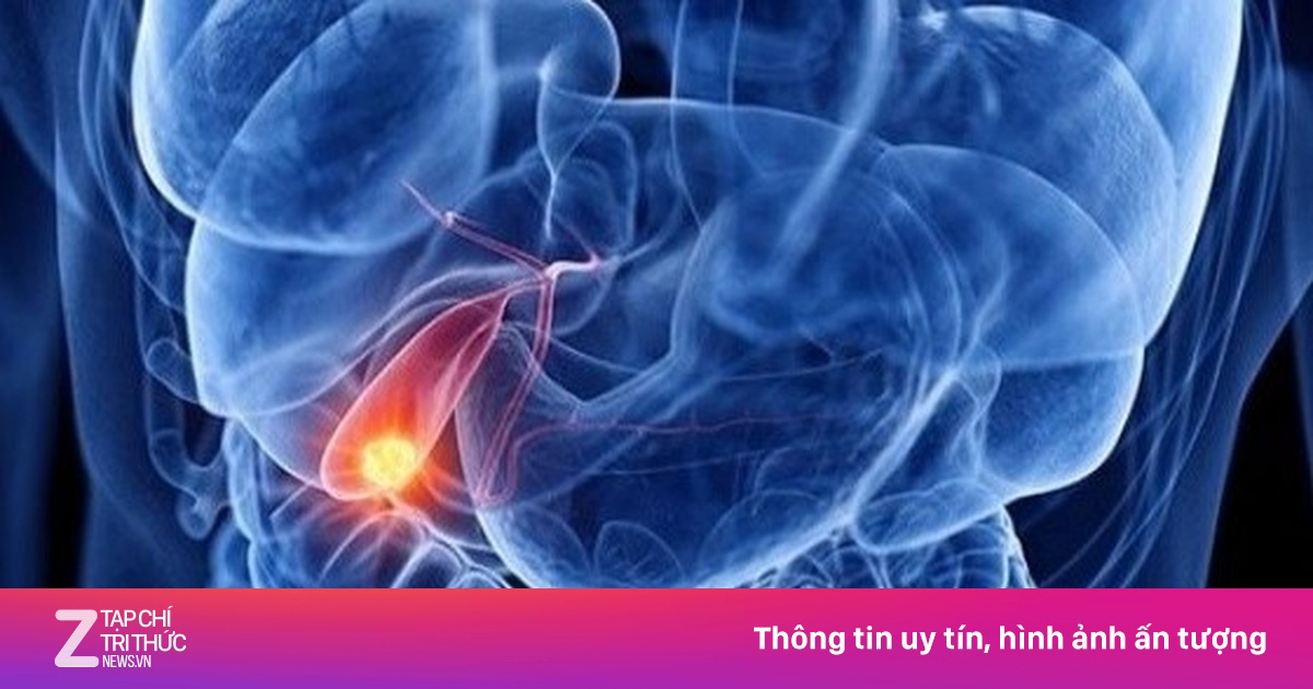 Bất ngờ nhận chẩn đoán ung thư giai đoạn cuối dù ăn ngon, ngủ tốt