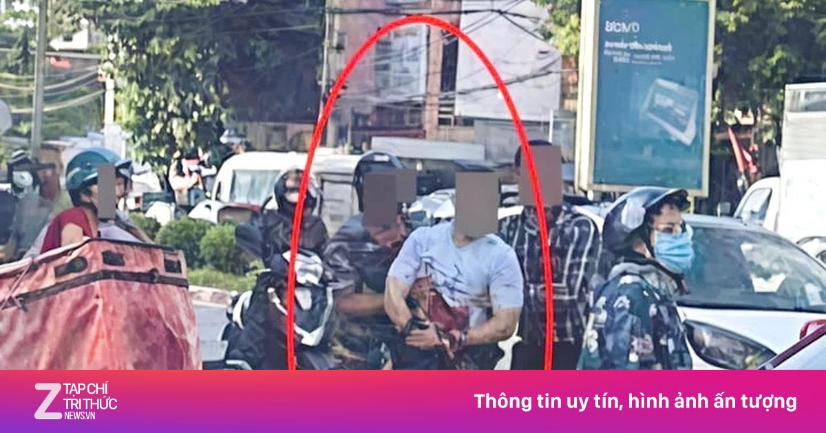 Image hình ảnh hình ảnh hình ảnh hình ảnh Nguyễn Thái Hà - Điều tra vụ một Tiktoker nổi tiếng bị chém đứt bàn tay giữa đường ...