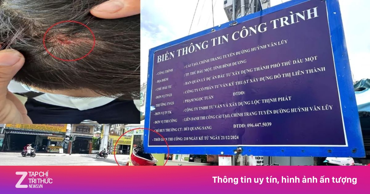 Nhiều người đi đường chảy máu đầu vì bảng thông tin trên vỉa hè TP.HCM
