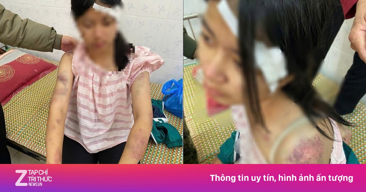 Hoàn cảnh bé gái bị dọa rút móng tay