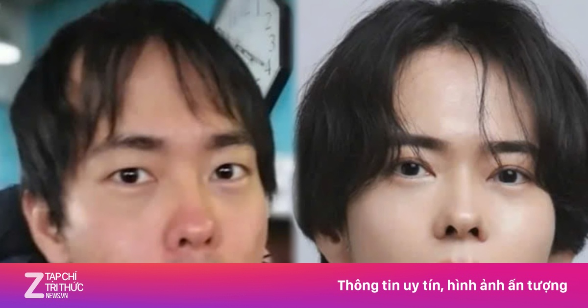 Chàng trai Nhật 'lão hóa ngược' nhờ làm điều này mỗi ngày 10 năm qua