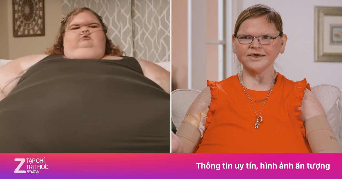 Nỗi sợ sau khi giảm hơn 200 kg