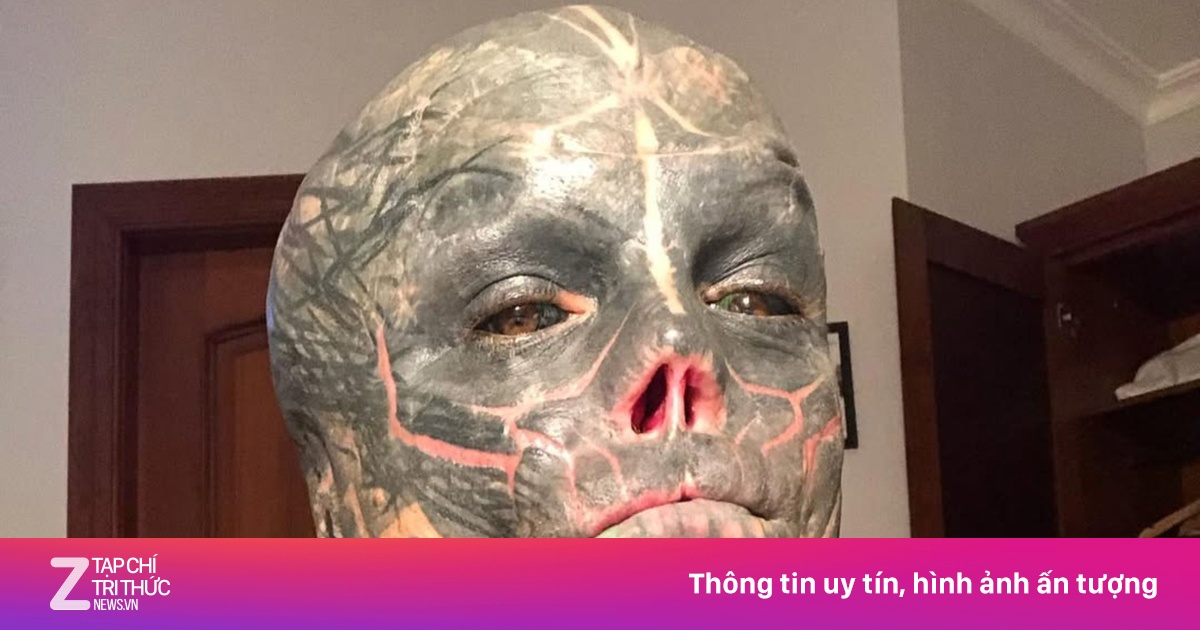 Trả Giá Đắt Vì Cắt Mũi, Xẻ Lưỡi Để Giống Người Ngoài Hành Tinh