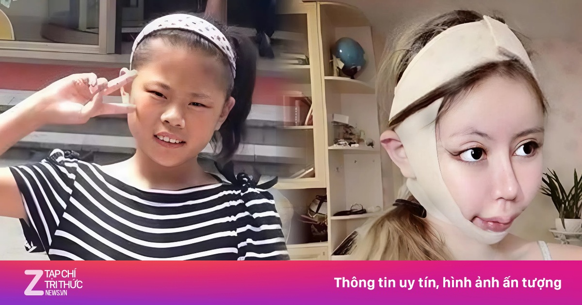 Cô gái 18 tuổi 'dao kéo' hơn 100 lần giờ ra sao?