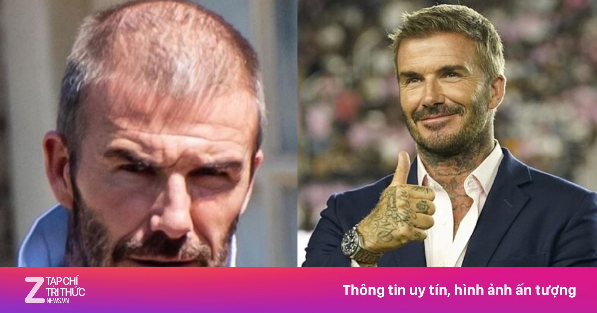 Dàn sao bóng đá 'đụng dao kéo' để lột xác ngoại hình