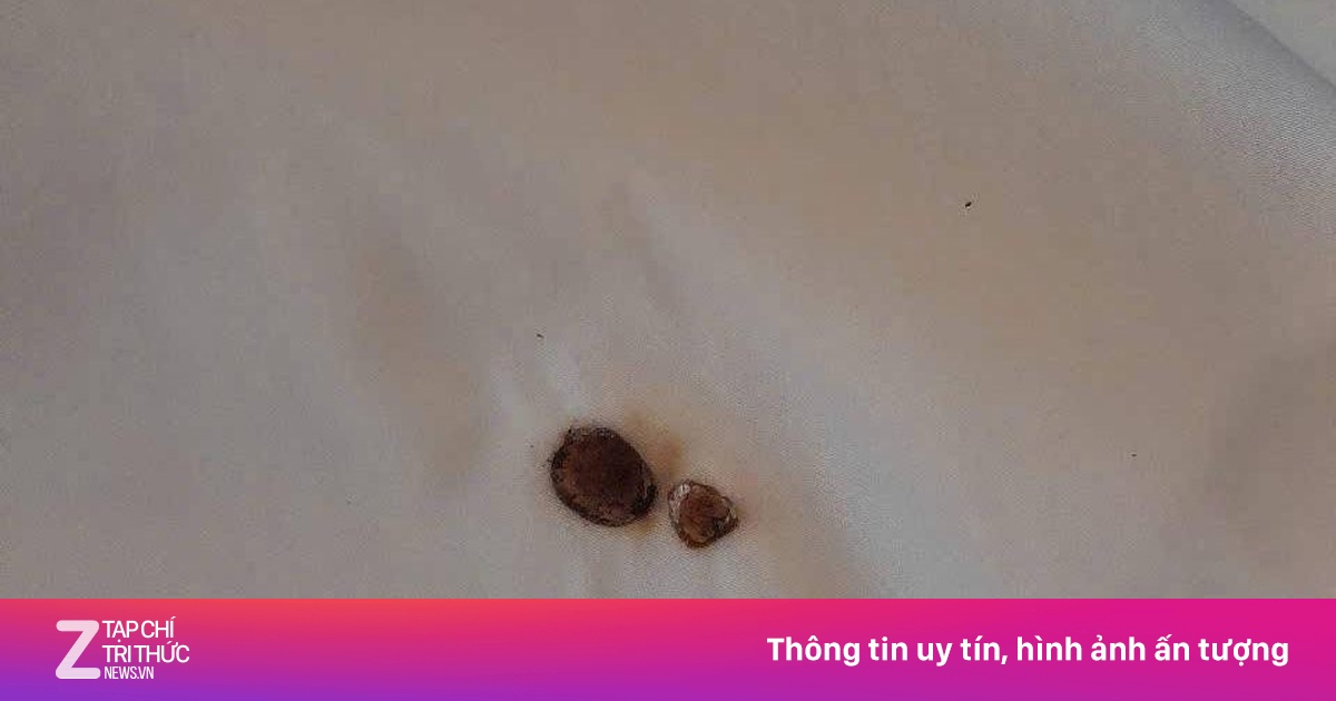 Khách hút thuốc cháy đệm, khách sạn Cửa Lò yêu cầu đền 4,8 triệu đồng