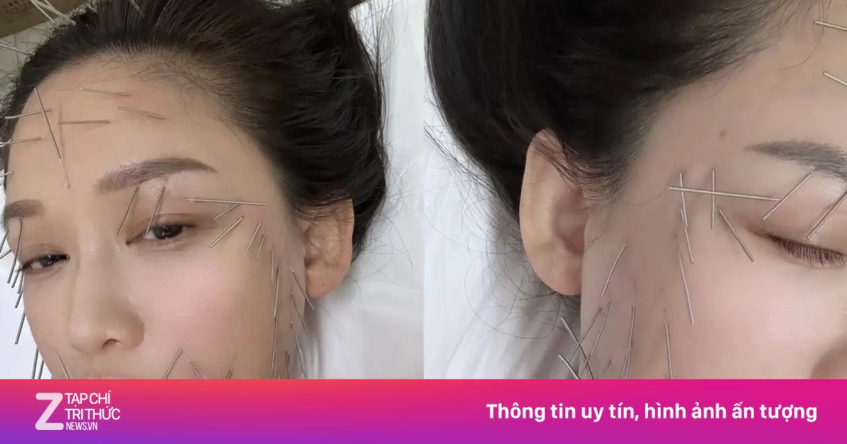 Trần Kiều Ân gây tranh cãi