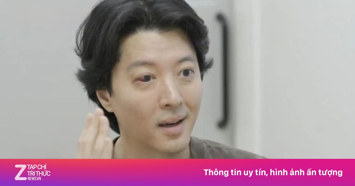 Gương mặt Lee Dong Gun biến dạng gây lo lắng