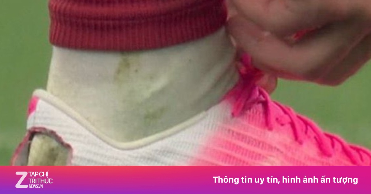 Chiếc giày rách của sao Bồ Đào Nha gây chú ý