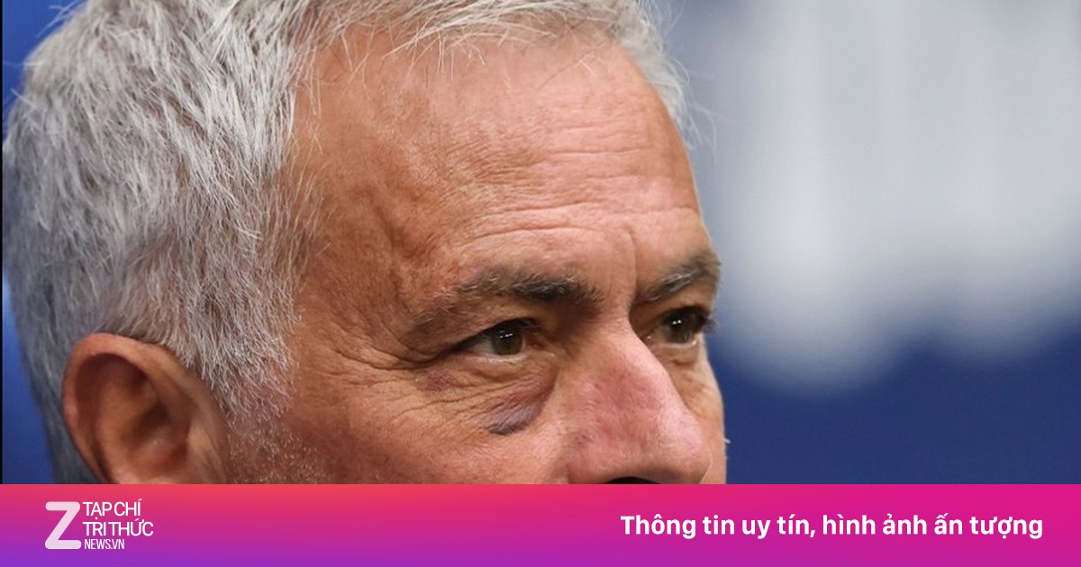 Vết bầm gây chú ý của Mourinho
