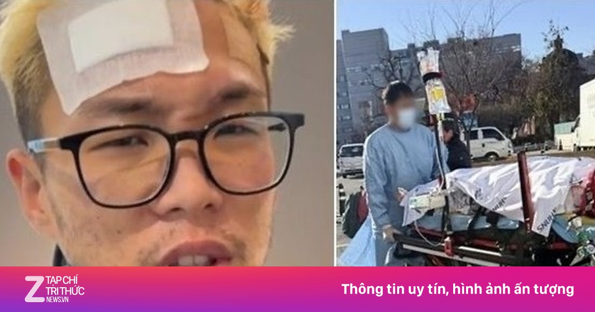 Ca sĩ Hàn Woodie Gochild kể lại tai nạn rơi từ tầng 3, suýt mất mạng