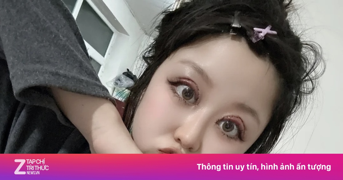 Chưa 30 tuổi đã lo cắt mí mắt